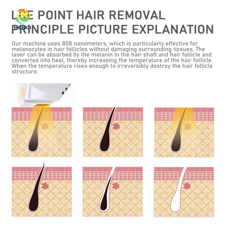 Portable Diode Laser 808 Laser Hair Removal Machine