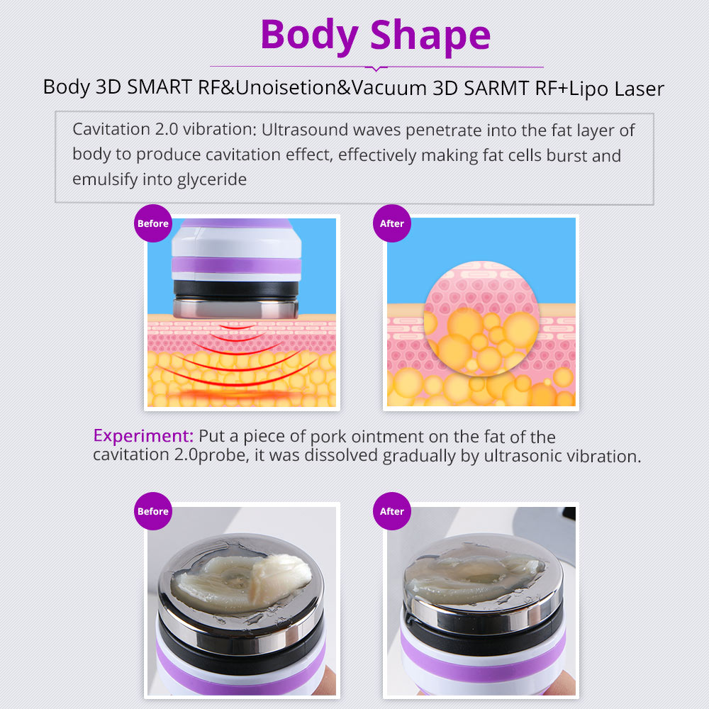 Liposuction body shaping system ultrasonic vacuum RF weight loss lipo laser slimming beauty machine