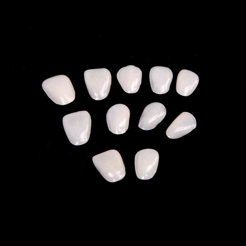 Dental Ultra Thin Anterior Temporary Crown Whitening Porcelain Teeth Medical Veneers Resin Teeth For Dental Care Y2208088639225