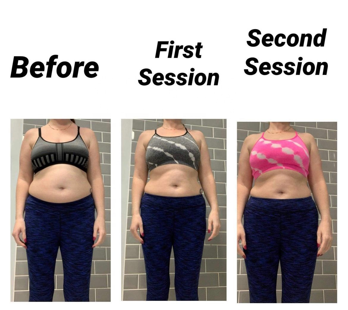 4Handle Emslim Vertical slimming and fat-reducing beauty instrument