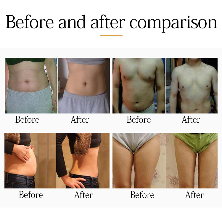 vacuum cavitation 80k weight loss machine 7 in 1 Bio ultrasonic RF slimming machine