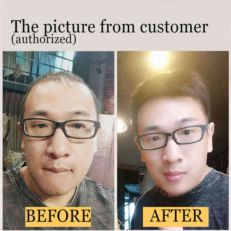 Synthetic Short Wigs Toupee Hair For Men's Male Black Wig Natural Young Man Balding Sparse Cut Style free shipping