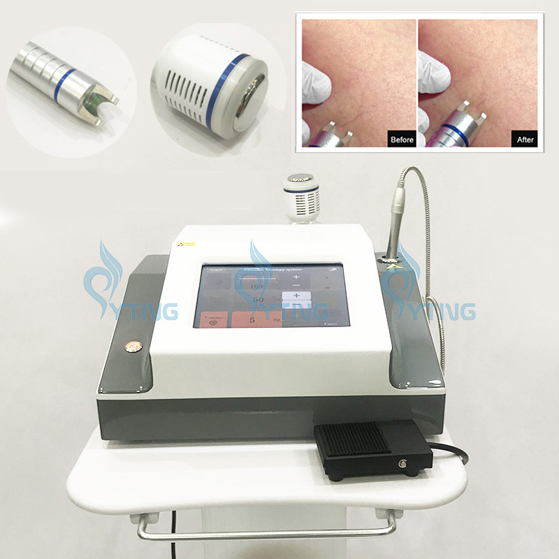 980nm Diode Laser Vascular Removal Other Beauty Equipment Red Blood Vessels Spider Veins Face Vein Remover Lazer Therapy with Cold Hammer
980nm Diode Laser Vascular Removal Other Beauty Equipment Red Blood Vessels Spider Veins Face Vein Remover Lazer Therapy with Cold Hammer