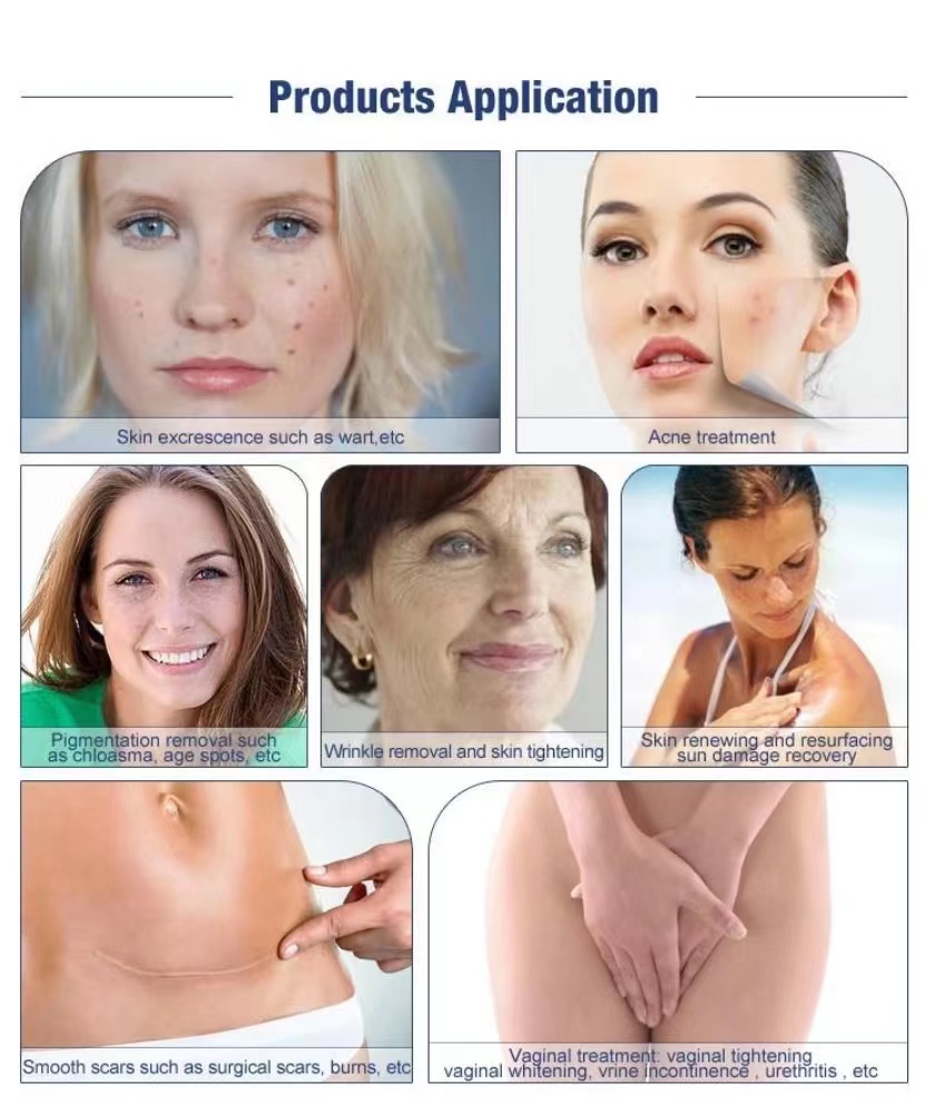 2022Fractional Co2 Laser Germany Co2 Fractional Laser Probe Accessories Scar Removal