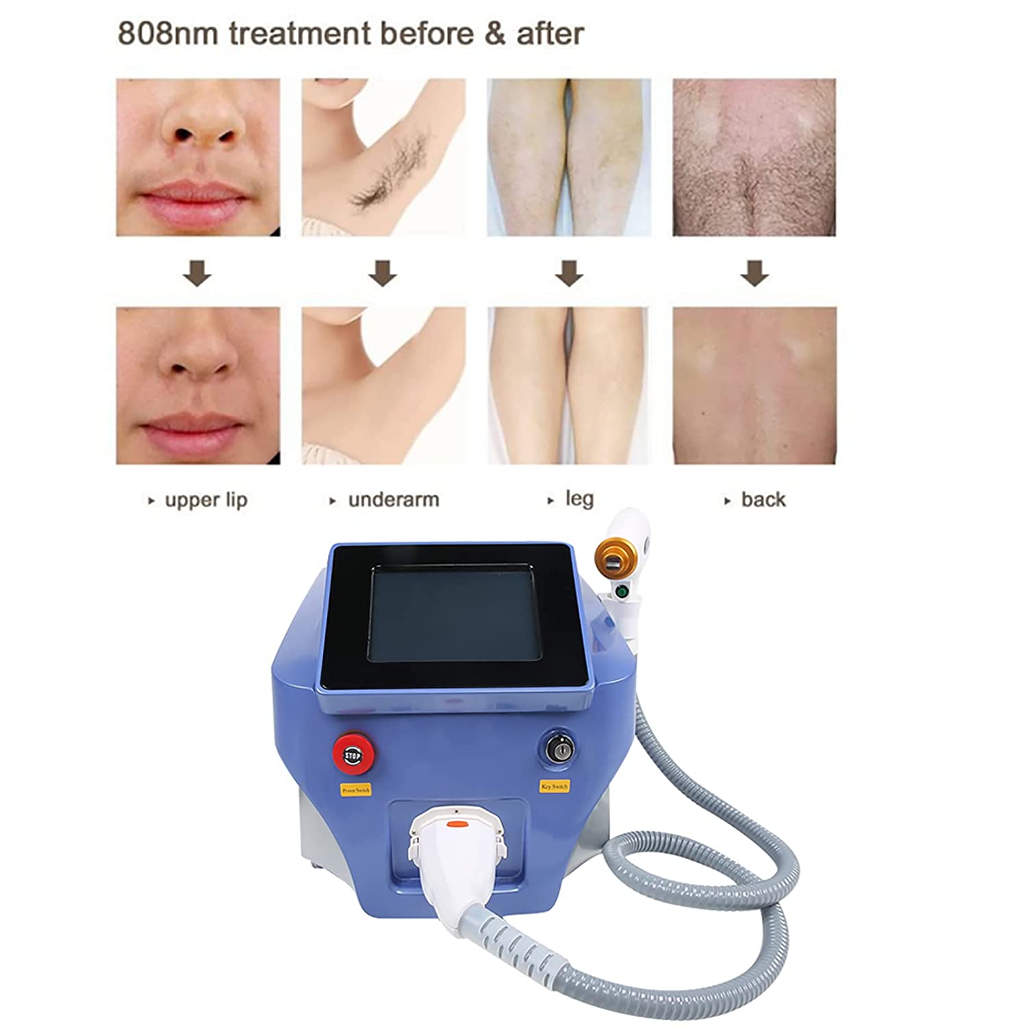Portable Salon Alexandrite Diode Laser 755 808 1064 Portable / 808 Diode Laser Hair Removal epilator machine Home