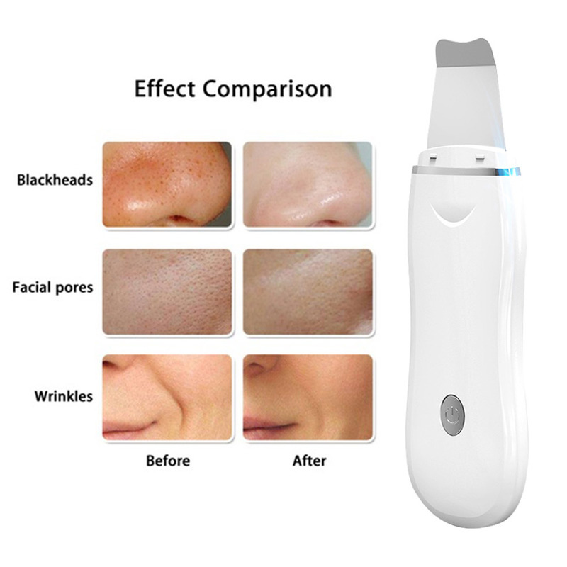 Ultra Skin ScrubberBlackhead Remover Electric Pore Cleaner spray Face Steamer massager instrumentEye beauty 220630