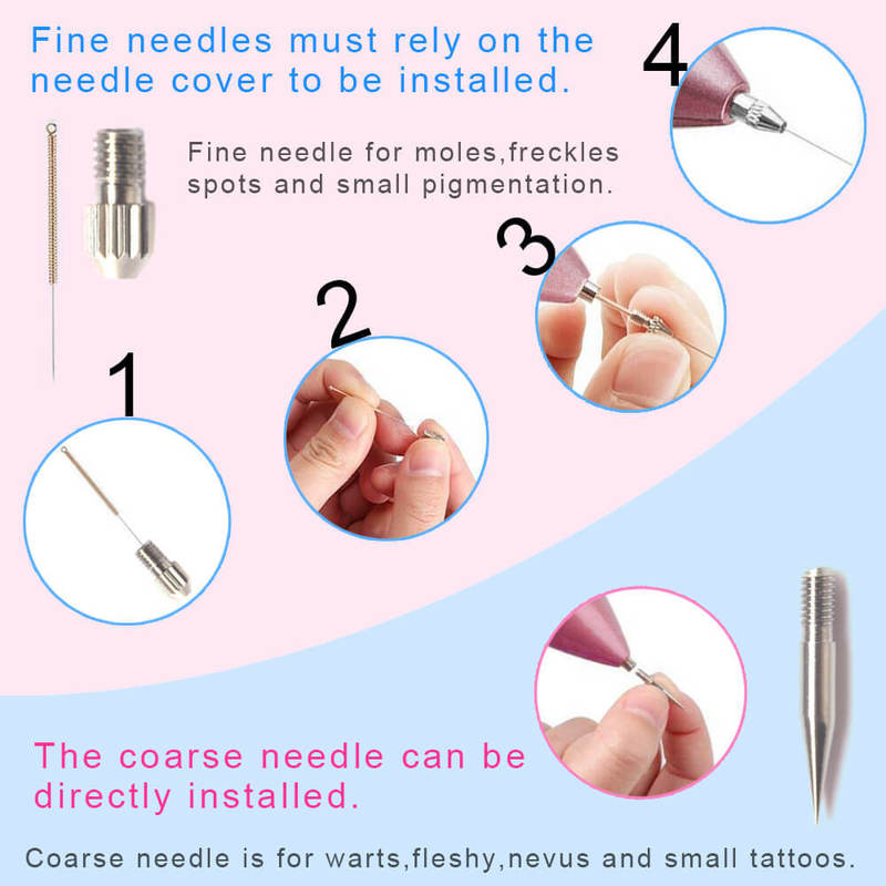 Laser Mole Removal Pen Wart Plasma Remover Tool Beauty Skin Care Corn Freckle Tag Nevus Dark Age Sweep Spot Tattoo Electric Set 220812