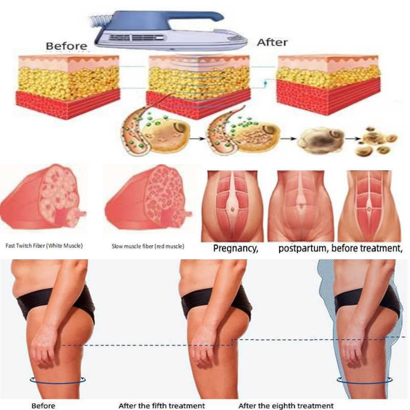 Portable Ems Body Sculpt Em Slim Neo Muscle Stimulator Machine / Emslim Neo Rf Emslim Machine