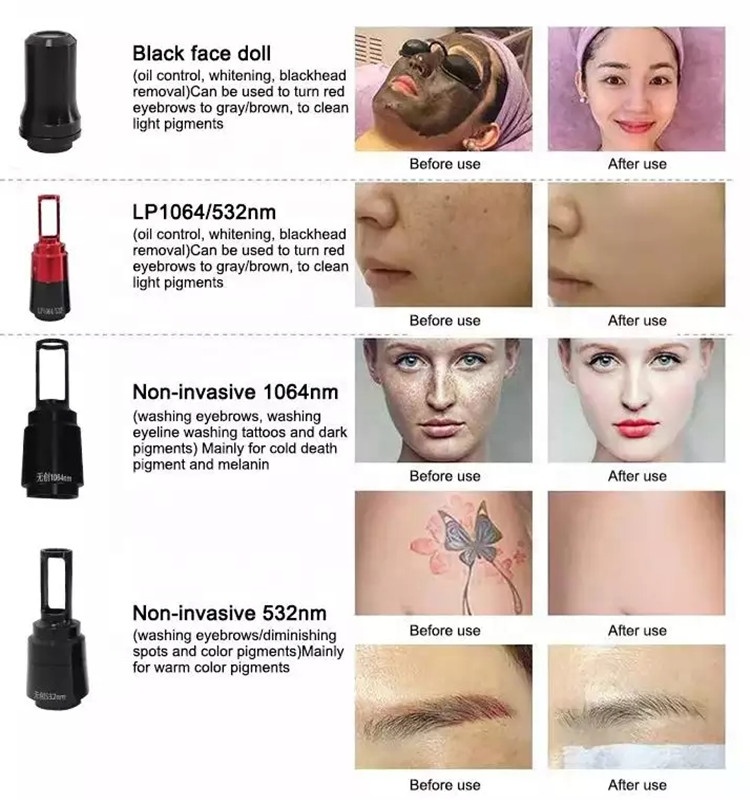 808nm diode hair removal q switched ndyag 755nm korea pico second laser tattoo removal machine