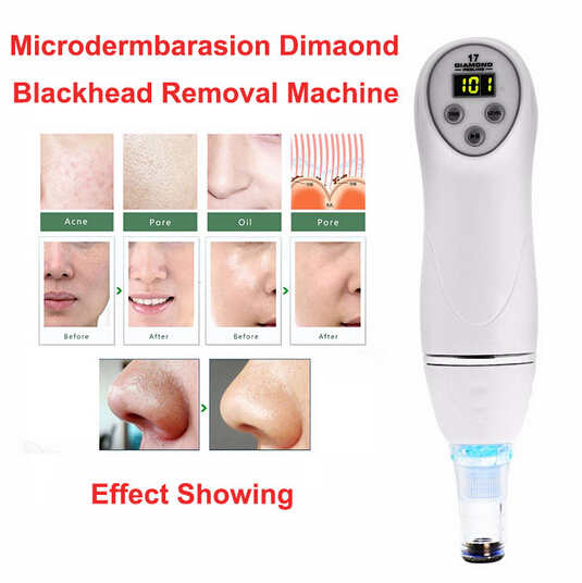Microdermabrasion Machine Blackhead Removal Skin Peel Diamond Dermabrasion Facial Massage 100V-240V New Beauty Equipment For Free Shipping