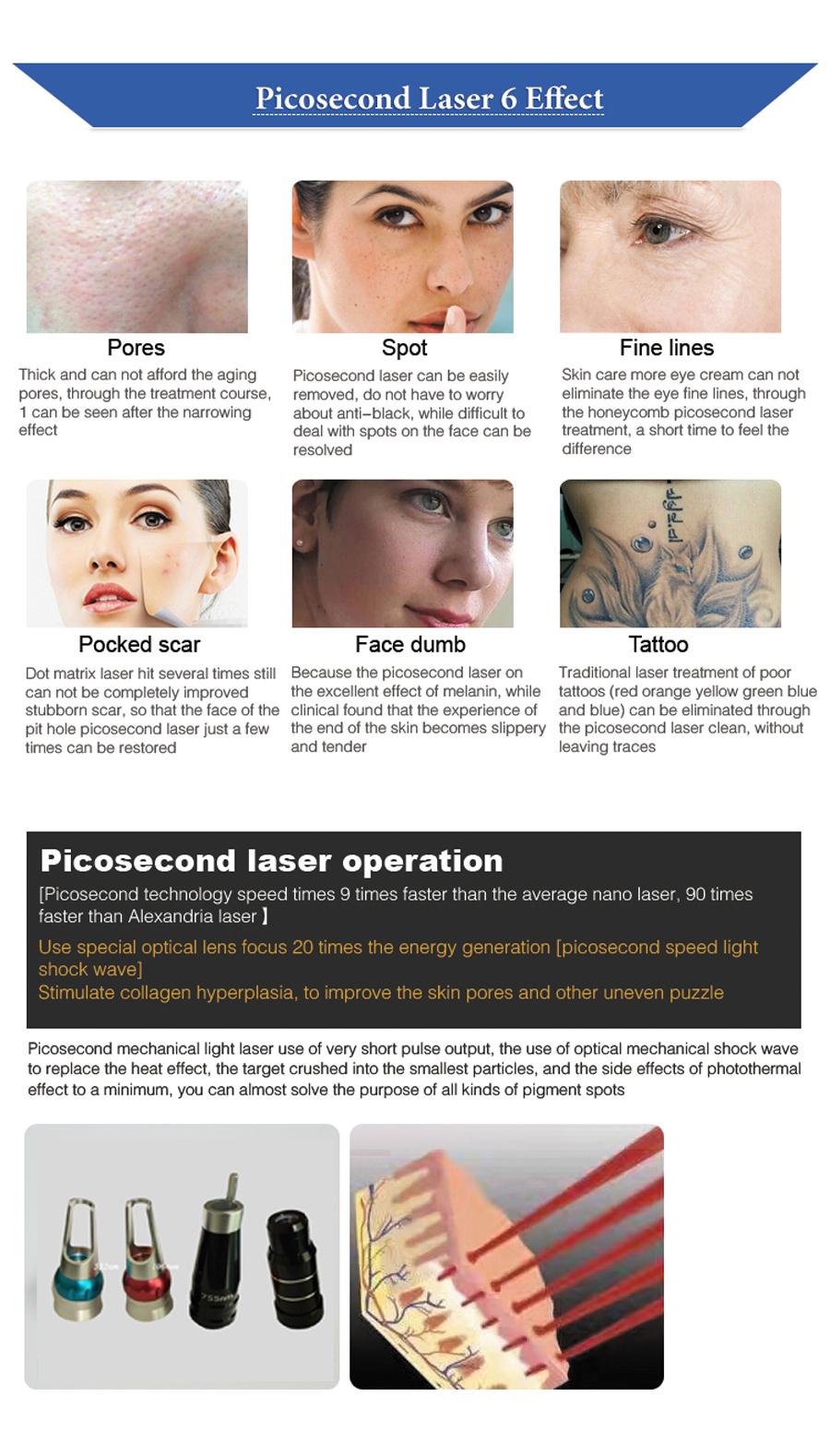 Pico laser tattoo removal skin rejuvenation beauty machine q switch salon spa laser skin care pigment spot removal 1064nm 532nm 755nm Picosecond