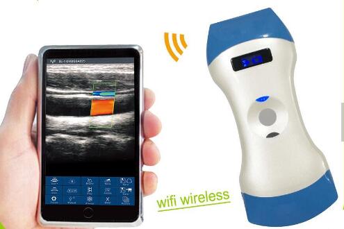 Wireless Mini Ultrasound Scanner showing image in smart phone/tablet through Wifi transferr Built-in and replaceable battery