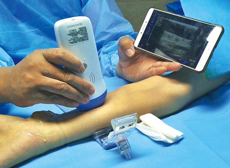Wireless Mini Ultrasound Scanner showing image in smart phone/tablet through Wifi transferr Built-in and replaceable battery