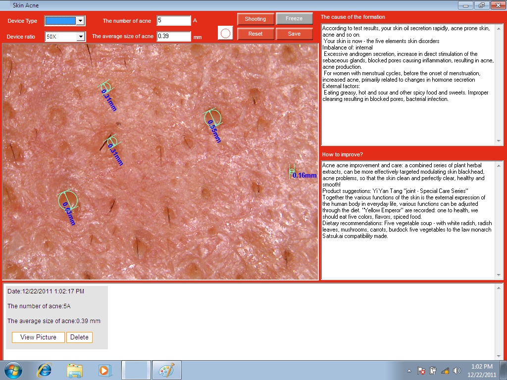 Promotion 5.0 MP High Resolution Digital CCD USB Skin Camera Skinscope Skin Analyzer Scope Diagnosis System including Software DHL