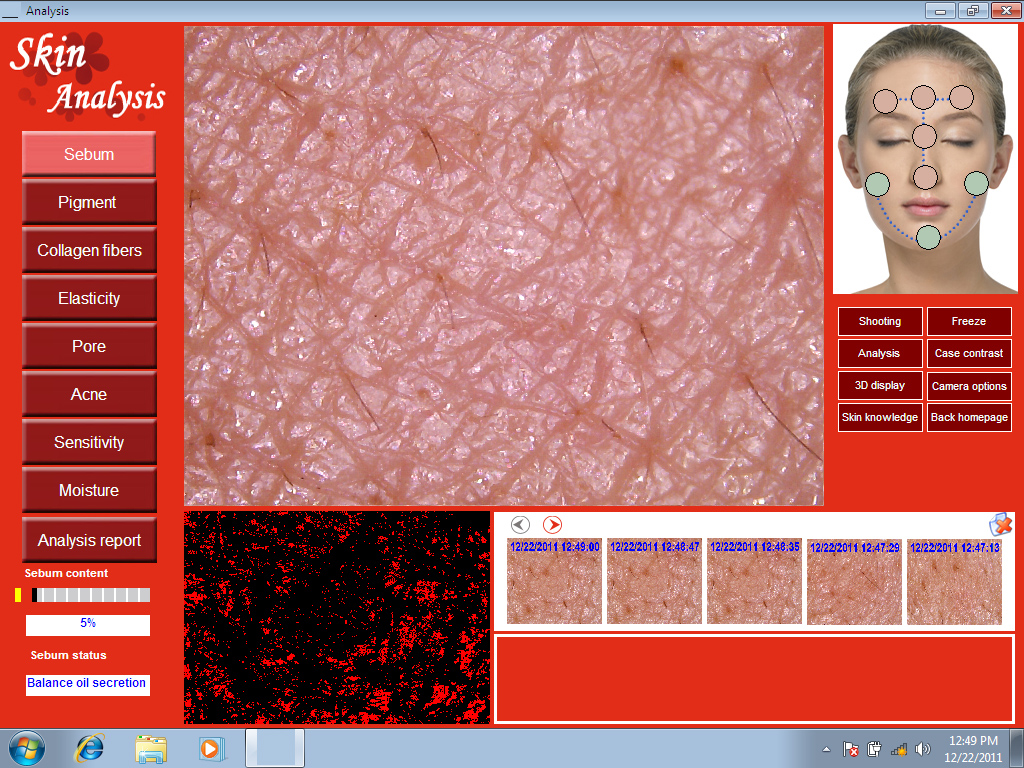 Promotion 5.0 MP High Resolution Digital CCD USB Skin Camera Skinscope Skin Analyzer Scope Diagnosis System including Software DHL
Promotion 5.0 MP High Resolution Digital CCD USB Skin Camera Skinscope Skin Analyzer Scope Diagnosis System including Software DHL