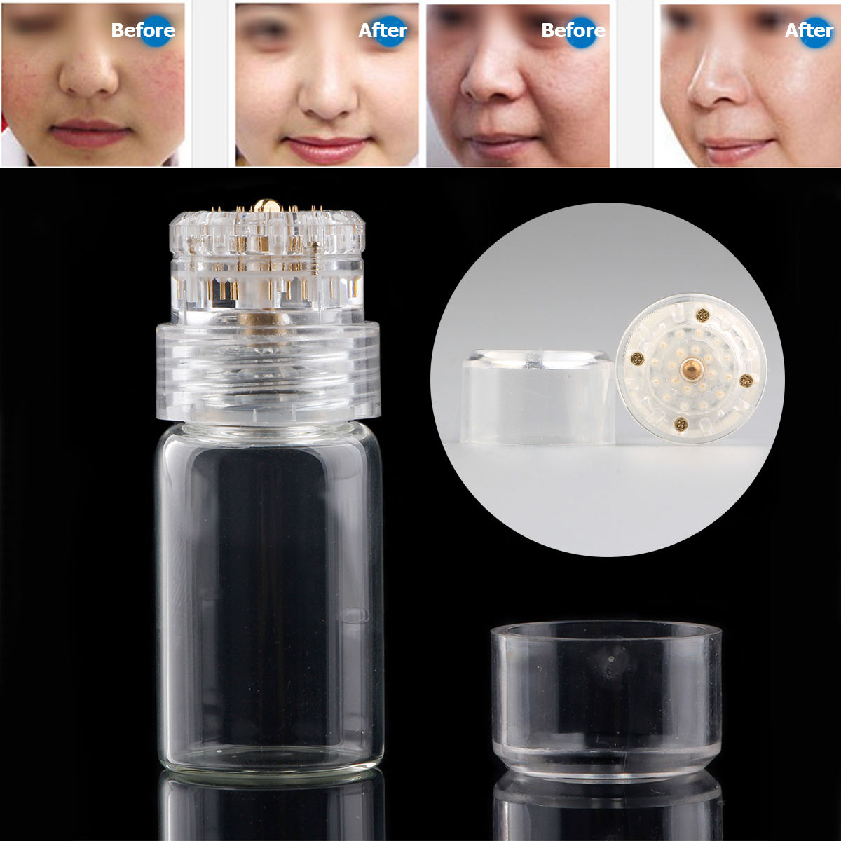 Hydra Needle 20 pins Titanium MicroNeedle Mesotherapy Skin Care Rejuvenation Whitening Anti Wrinkle derma stamp Serum Applicator
Hydra Needle 20 pins Titanium MicroNeedle Mesotherapy Skin Care Rejuvenation Whitening Anti Wrinkle derma stamp Serum Applicator