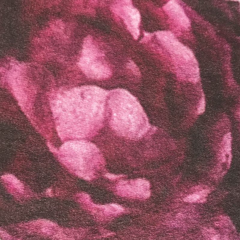 Zeegle Floral 3Pcs Bathroom Mat Set Anti-slip Bathroom Floor Rugs Cushion Toilet Seat Cover Toilet Bath Mat Carpet Set