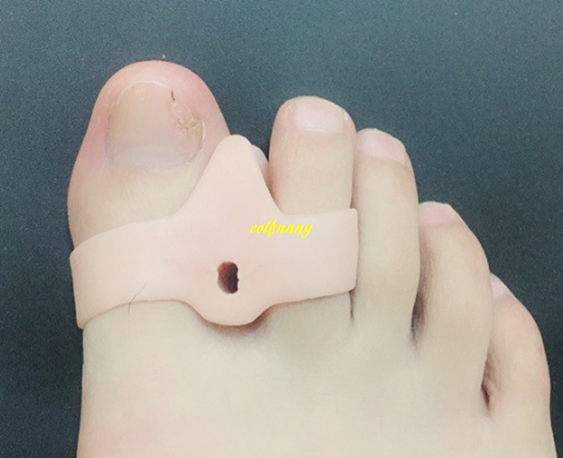 100Paris/lot Silicone Gel Thumb Corrector Hallux Valgus Foot Bone Orthosis Device Feet Care Double Ring Appliance Brace Support