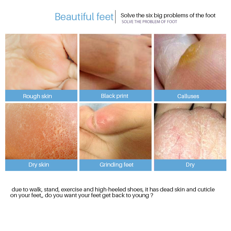 Feet Exfoliating Foot Mask For Legs Lavender Heels Magic Skin Peeling Dead Skin Feet Mask Socks For Pedicure Mascarilla Exfoliante Para Pies Peeling D