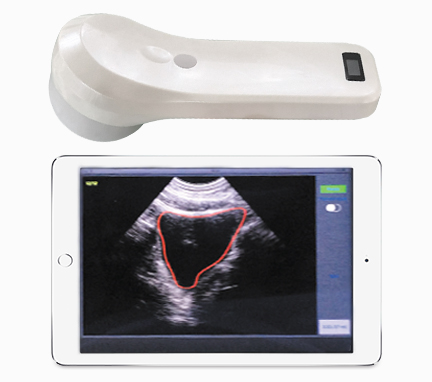 Wireless Mini Ultrasound Scanner showing image in smart phone/tablet through Wifi transferr Built-in and replaceable battery
