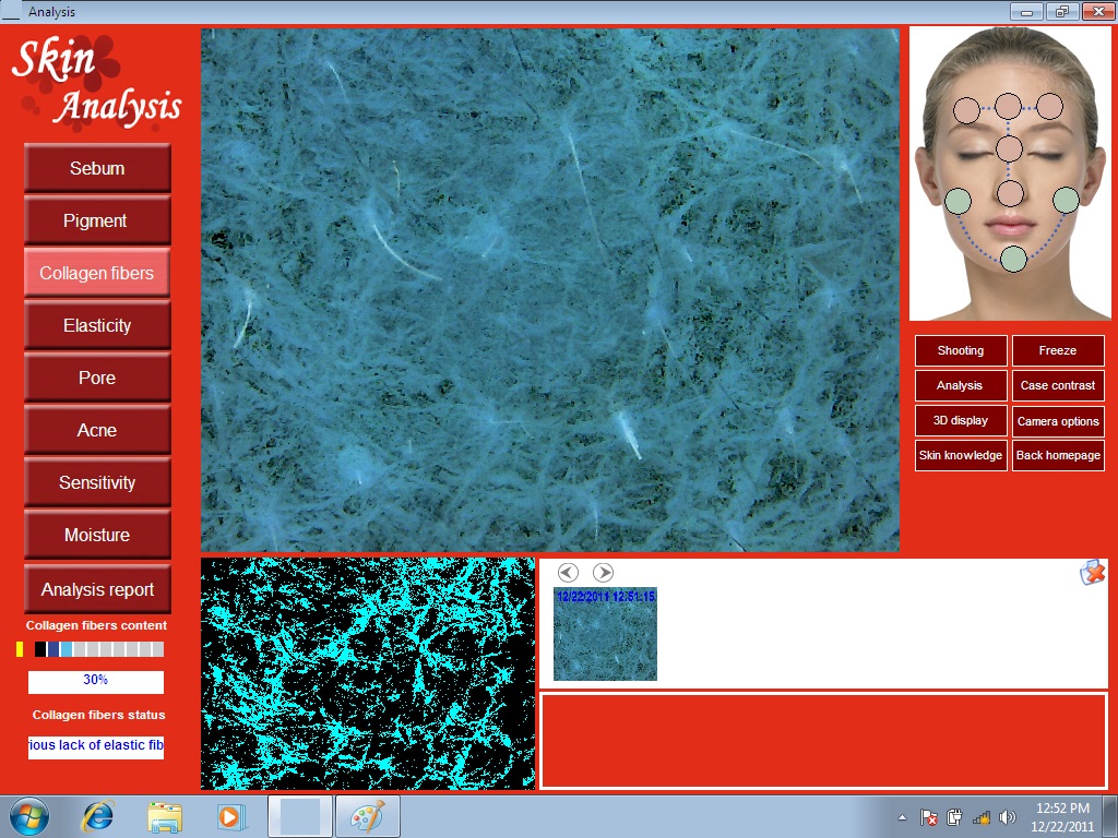 Promotion 5.0 MP High Resolution Digital CCD USB Skin Camera Skinscope Skin Analyzer Scope Diagnosis System including Software DHL