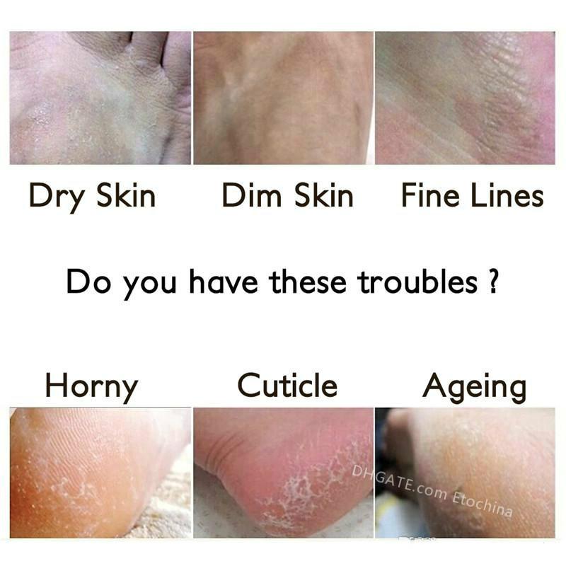 ROLANJONA Milk Bamboo Vinegar Feet Mask Peeling Exfoliating Dead Skin Remove Sox Foot Sticker Health Care Mascarilla Para Pies Con Vinagre De Bambu Y 