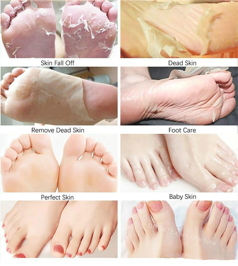 ROLANJONA Milk Bamboo Vinegar Feet Mask Peeling Exfoliating Dead Skin Remove Sox Foot Sticker Health Care Mascarilla Para Pies Con Vinagre De Bambu Y 