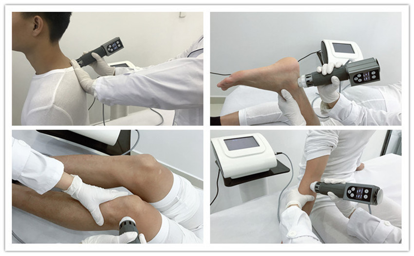 Hot sale shock wave therapy machine for body pain and weight loss/Portable shockwave therapy machine for ED treatment
Hot sale shock wave therapy machine for body pain and weight loss/Portable shockwave therapy machine for ED treatment