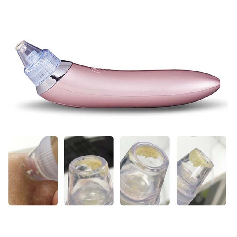 Wholsale Facial Blackhead Remover Vacuum Dead Skin Acne Pore Peeling Device Cleaning Skin Beauty Tool Suck Out Blackhead Plug-in Machine от DHgate WW