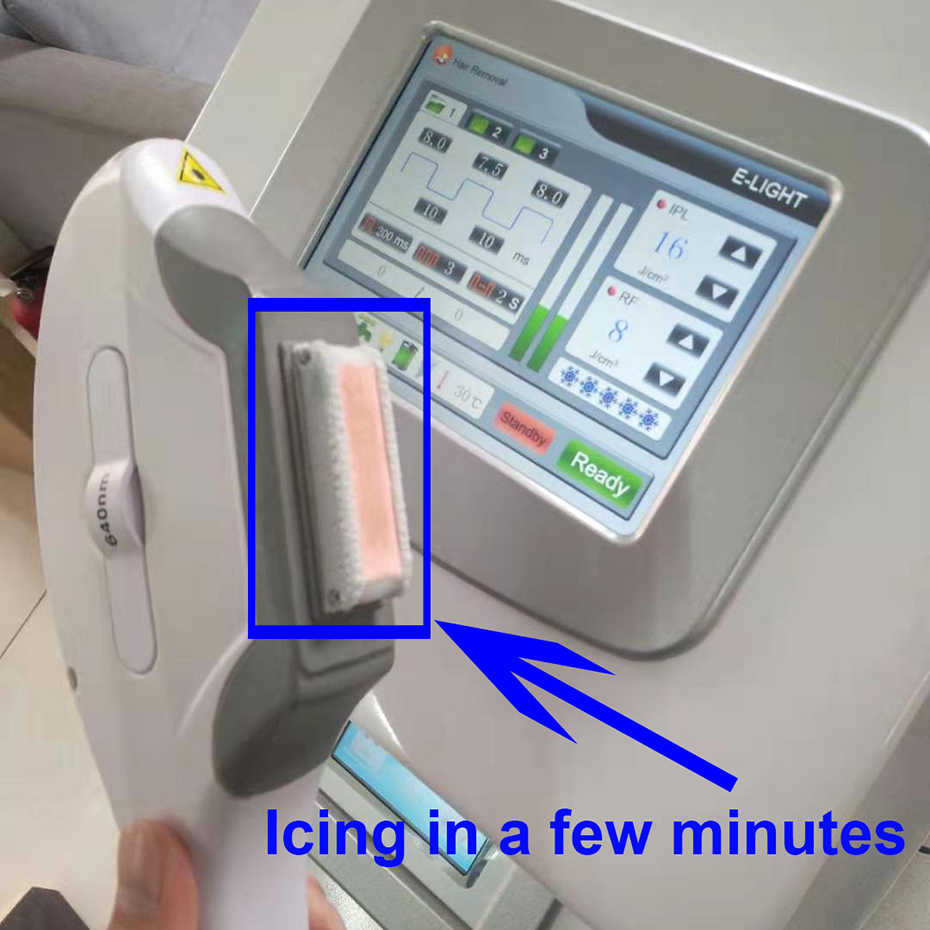 5 in 1 Multifunction Strong Energy OPT IPL Laser Hair Removal ND YAG Laser Tattoo Removal Beauty Machine IPL&RF & ND YAG&Elight salon spa equipment