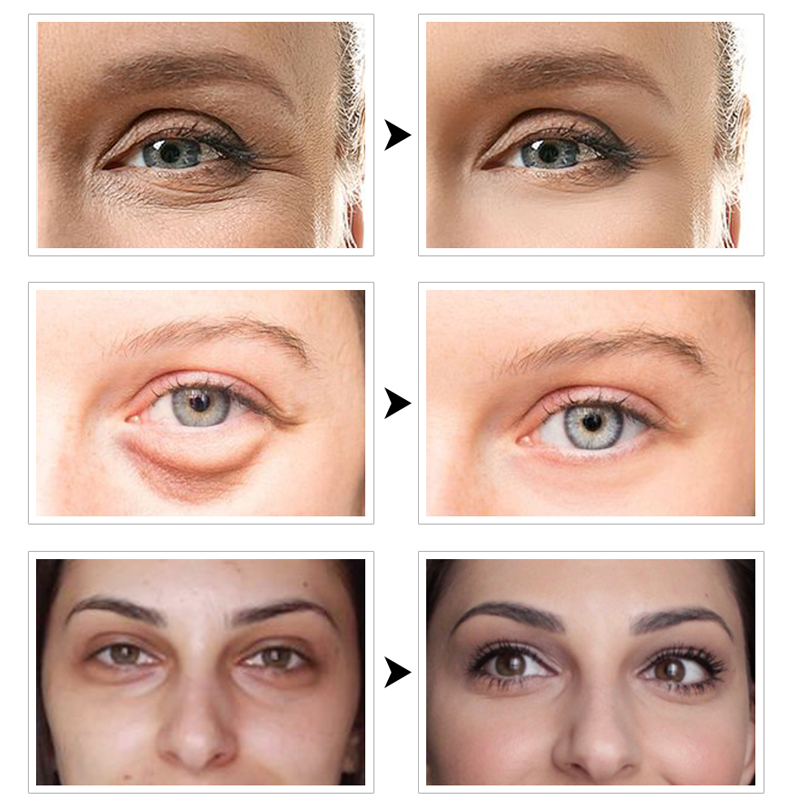 Collagen Crystal Eye Mask Gel Eye Patches Sleep Masks Dark Circles Bag Patches For Mask Care