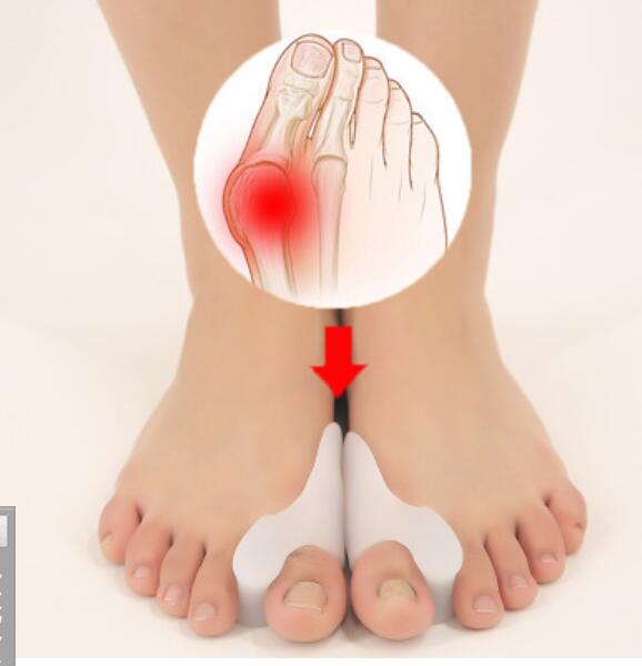 Free shipping Silicone Toe separator health care foot treatment Hallux valgus orthosis Toes valgus corrector
Free shipping Silicone Toe separator health care foot treatment Hallux valgus orthosis Toes valgus corrector