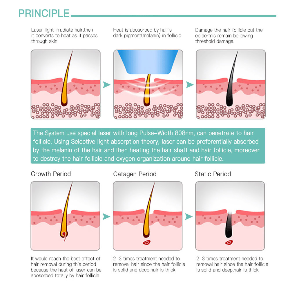 NEW IPL Permanent Laser Hair remover skin rejuvenation device pigmentation removal home use beauty