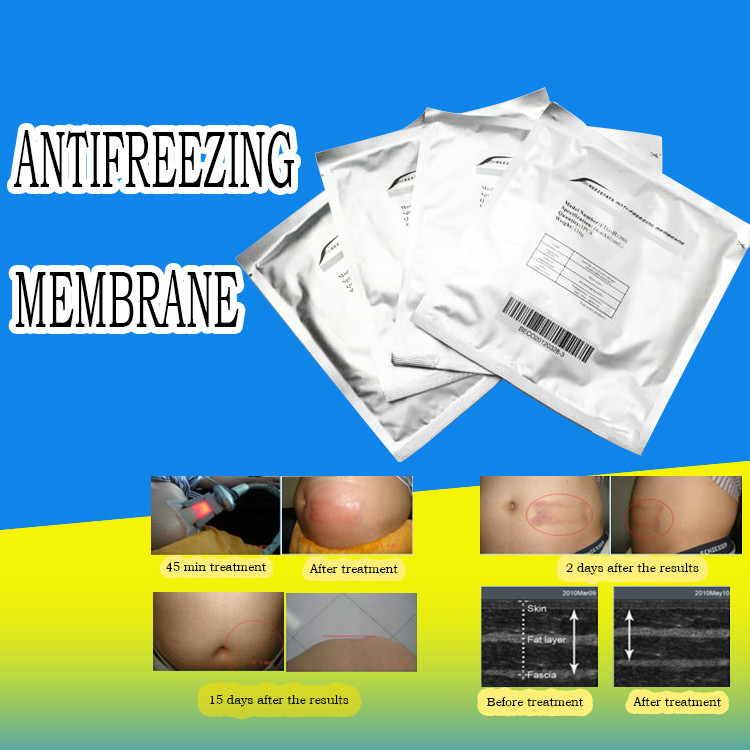 Top good review 3size Antifreeze Membrane Antifreezing membrane Anti-freezing Membrane pad for cold weight loss cryo therapy machine
Top good review 3size Antifreeze Membrane Antifreezing membrane Anti-freezing Membrane pad for cold weight loss cryo therapy machine