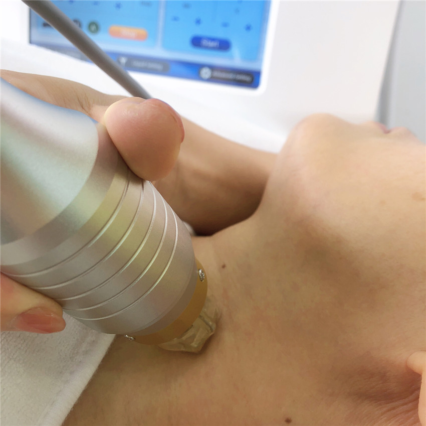 Portable fractional rf microneedling collagen induction therapy machine for stretch marks Fractional RF skin needing machine
Portable fractional rf microneedling collagen induction therapy machine for stretch marks Fractional RF skin needing machine
