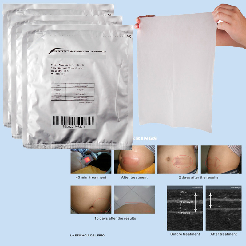 arrival antifreeze membrane 2730cm 2828cm 3442cm antifreezing membrane antifreezing membrane pad for cryotherapy high quality
arrival antifreeze membrane 2730cm 2828cm 3442cm antifreezing membrane antifreezing membrane pad for cryotherapy high quality