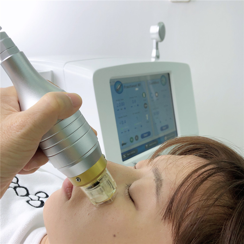 Portable Microneedle & Fractional RF skin resurfacing and skin lifting Fractional RF theramage collagen induction therapy for skin lifting
Portable Microneedle & Fractional RF skin resurfacing and skin lifting Fractional RF theramage collagen induction therapy for skin lifting
