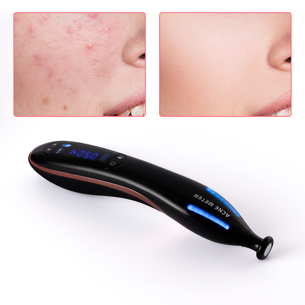 Blue Light Plasma Pen Scar Acne Removal Machine Anti Wrinkle Shrink Pores Ozone Therapy Pen Facial Skin Care Tool Beauty Device