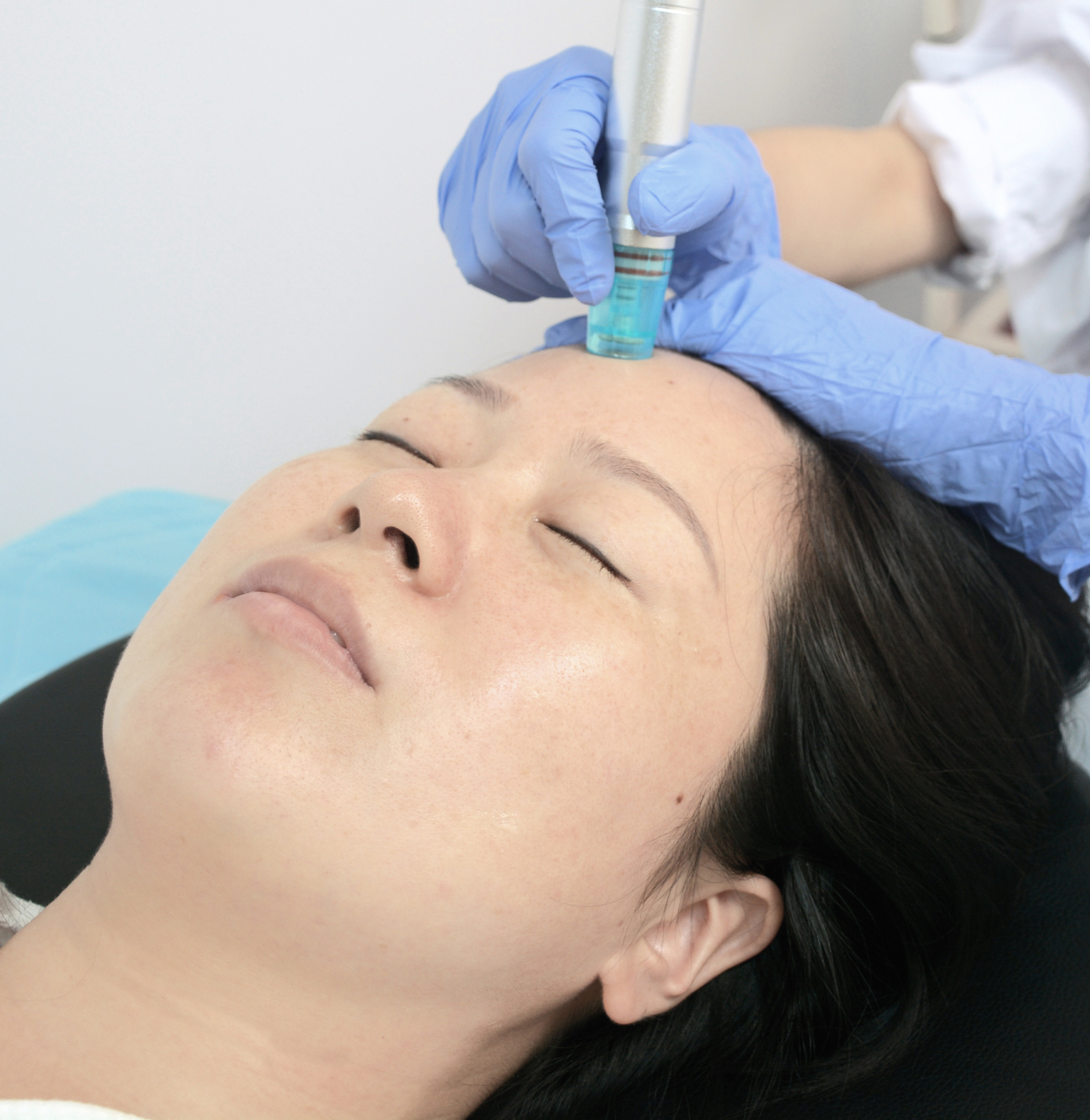 Microdermabrasion facial care machine oxygen infusion and gentle exfoliation skin hydration therapy machine for home use