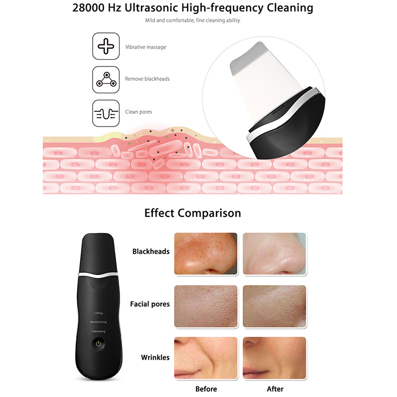 Rechargeable Ultrasonic Face Skin Scrubber Facial Cleaner Peeling Vibration Blackhead Removal Exfoliating Pore Cleaner Tools