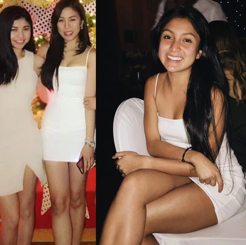 Fashionable Urban-style Business Women's Dress - Hot Girl Style Tight-fitting Dress With Raincoat-style Sexy Shoulder Straps - Party Dress For Wh