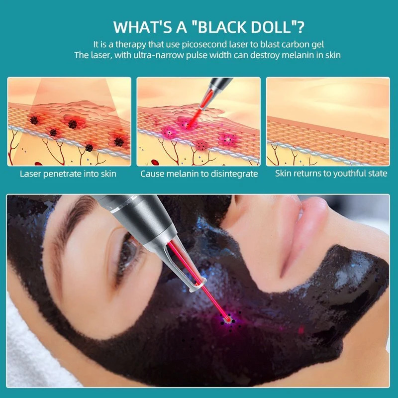 Carbon Gel Black Face Cream Mask Facial Deep Cleaning Support Laser Active Nano Toner Skin Rejuvenation Whitening Care Tools 260119