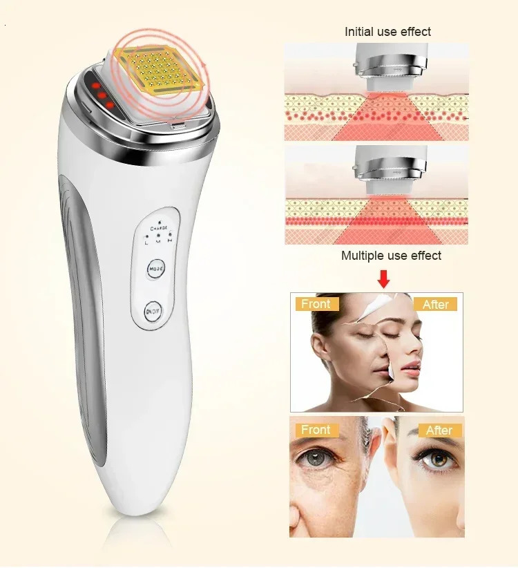 RF Radio Frequency Face Device Dot Matrix Beauty Massager Home r Skin Massage Machine 260113