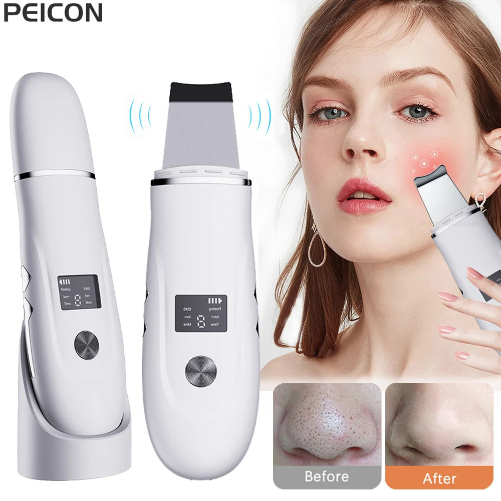 Ultrasonic Face Scrubber Peeling Skin Deep Cleaning Spatula Acne Pore Ultrar Cleanser 260108