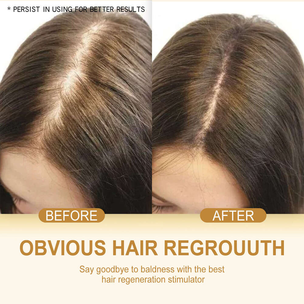 EELHOE Ginger Care Shampoo Gentle Cleansing Scalp Thick Anti-Fall Strong Natural Black Hair