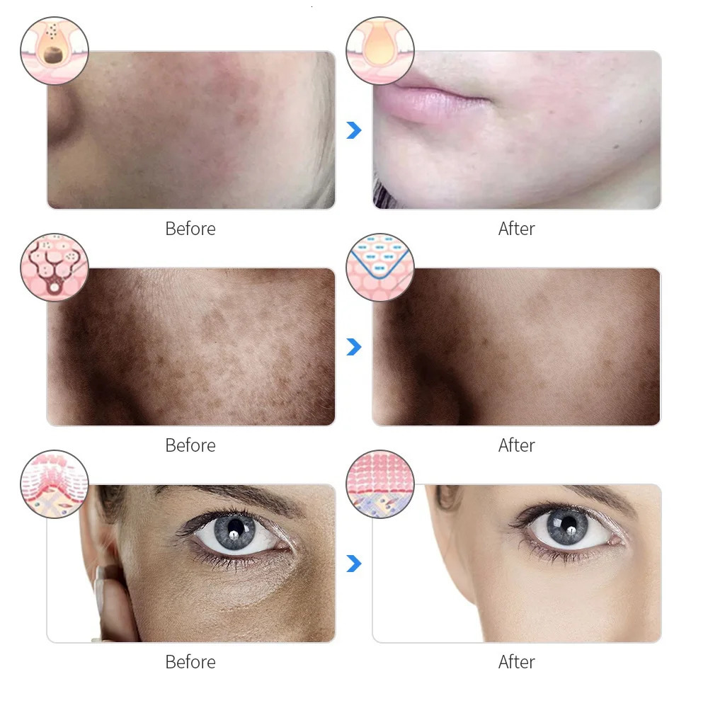 Rechargeable LED Mask 7 Colors Pon Beauty Skin Rejuvenation Home Face Lifting Whitening Care 260108