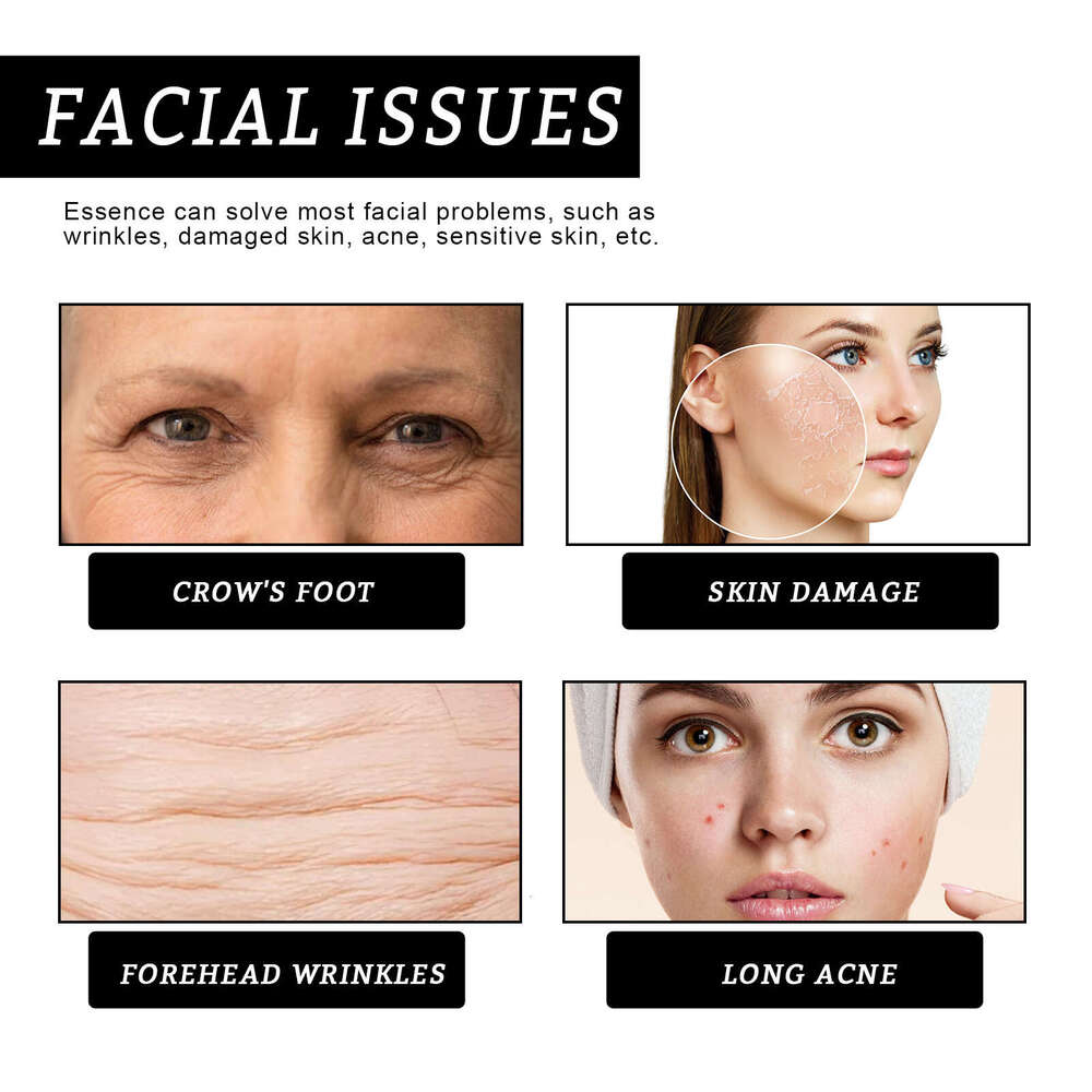 Hoygi Anti-Wrinkle Serum Hydrating Repair Skin Barrier Elasticity Firming Brightening Facial Fade Spots Fine Lines