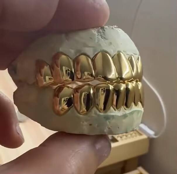 2026 Custom Iced Out Hiphop Rock Grillz Teeth 10k Gold Plated 925 Sterling Silver Perm Cut Grillz for Teeth