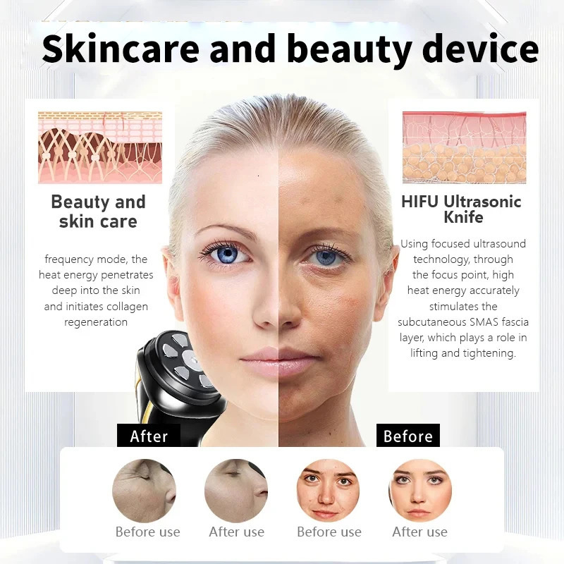 Mini HIFU 4-in-1 Ultrasonic Ems Micro Current Face Lift Rejuvenating Resistant Massager 260307