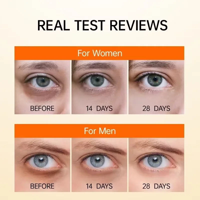 Anti Dark Circle Eye Serum Oil Retinol Anti Firming Skin Eye Bag Fade Fine Line Brighten Eye Care Korea 260318